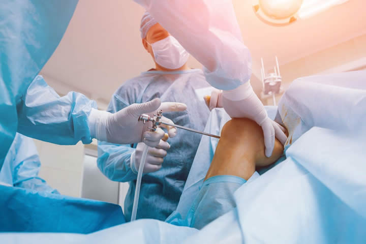 Artroscopia de genunchi