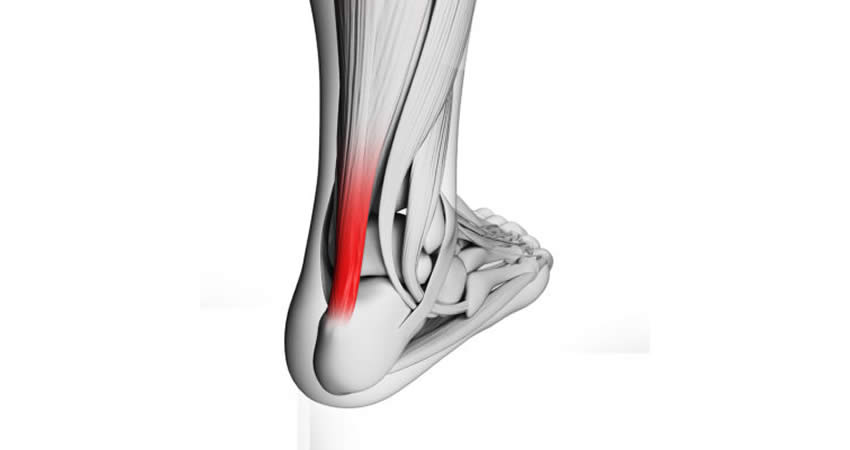 Recuperarea dupa ruptura tendonului achilian